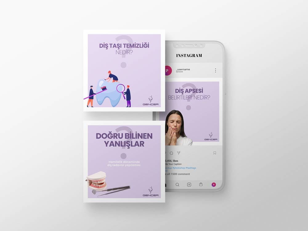 gencer-dental-dis-protezi